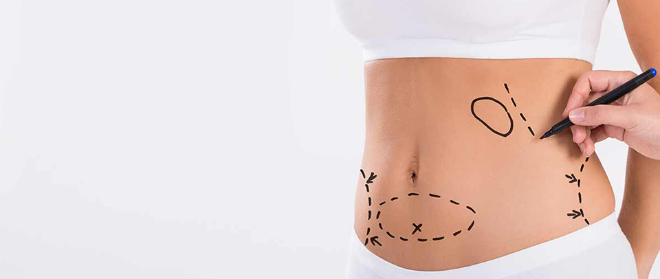 liposuction surgery treatment
